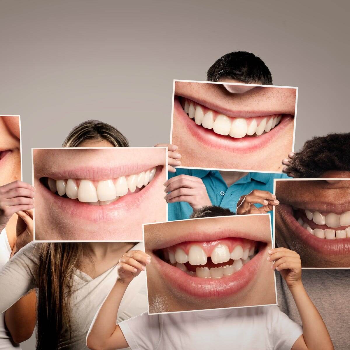 سالم و تمیز بودن دندان‌ها در زیبایی چهره افراد تاثیر دارد.