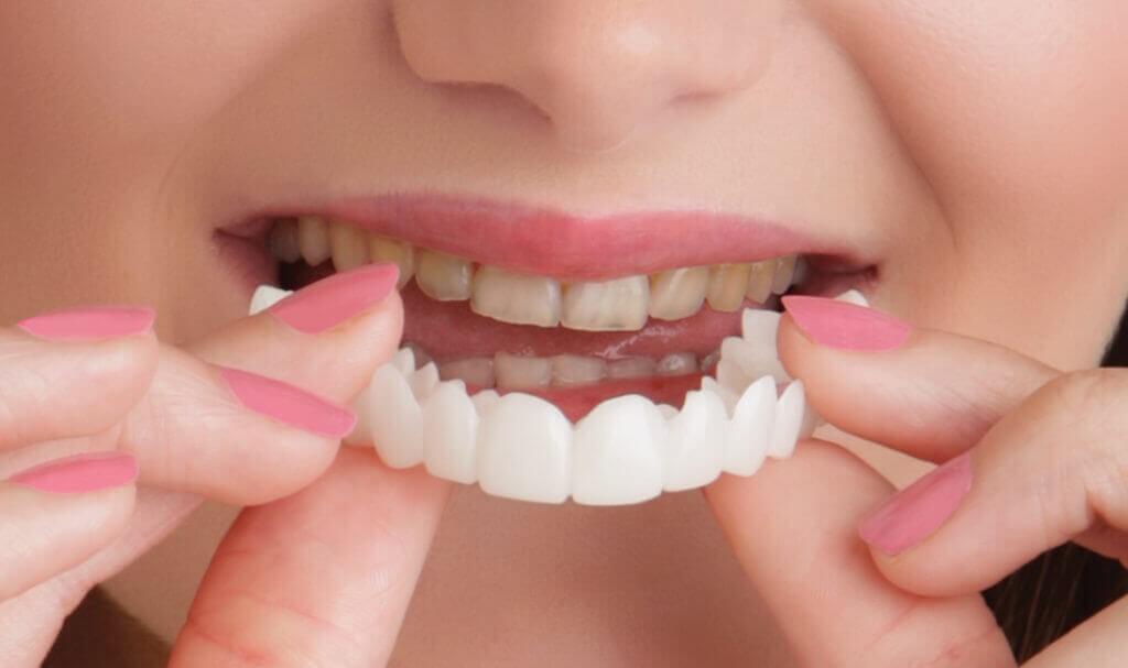از مواد مختلفی برای پر کردن دندان‌ها استفاده می‌شود.