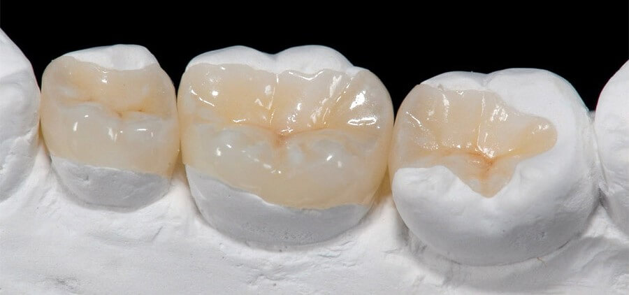 پزشکان در درمان بيماران با استفاده از سمان دنداني با محدوديت مواجه نيستند.