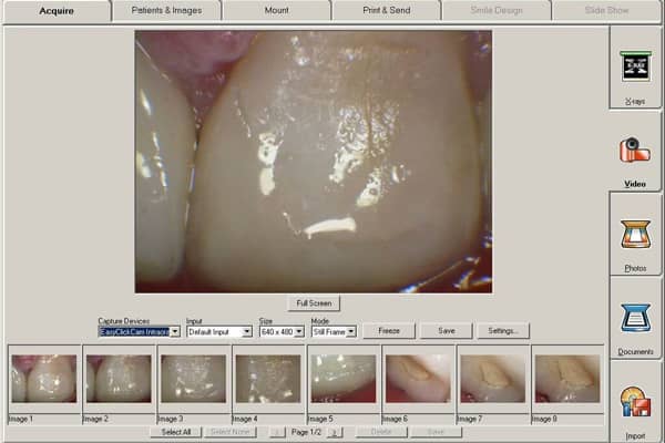 نرم افزارهایی که به کمک تفسیر تصاویر گرفته شده با دوربین دهانی می آیند